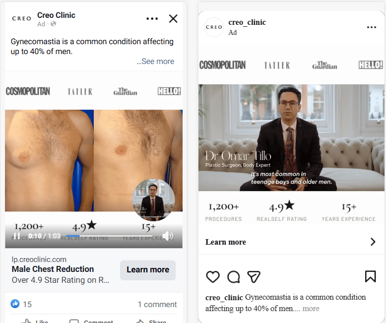 Creo Clinic Gynecomastia Ad Campaign